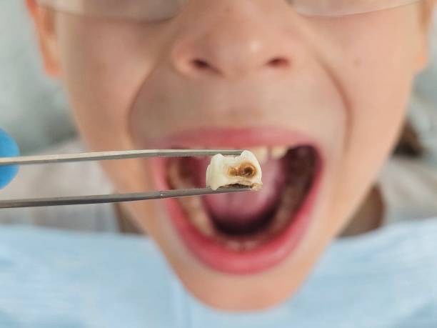 Best Pediatric Emergency Dentist in Fox Chase, PA
